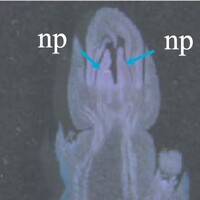 img example